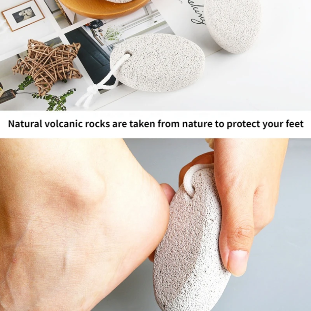 Natural Pumice Stone – Foot Hard Skin Callus Remover | Dead Skin Pedicure Tool | Smooth Skin Z Foot Care MegoDeals