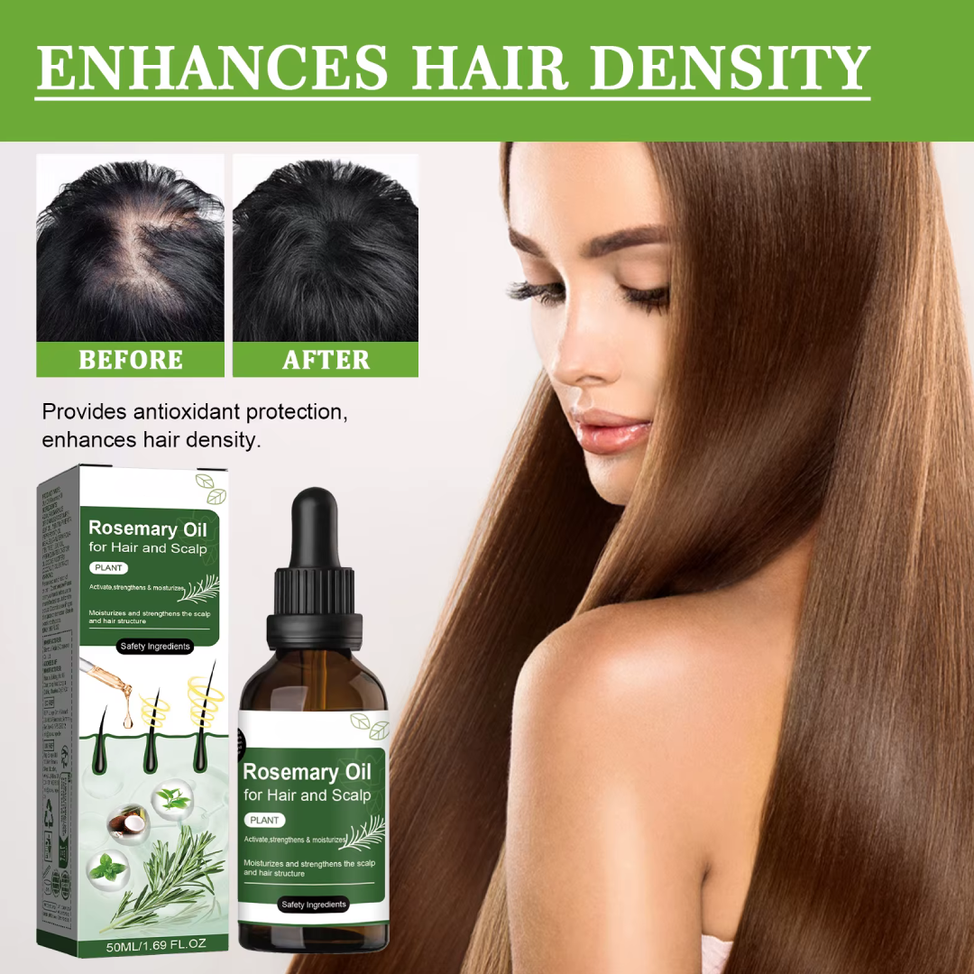 Rosemary Hair Oil – Anti Hair Loss & Hair Growth Scalp Treatment Ouhoe