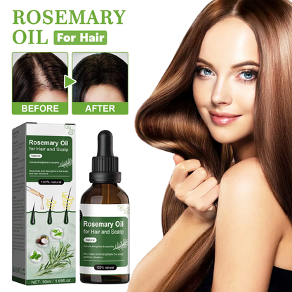 Rosemary Hair Oil – Anti Hair Loss & Hair Growth Scalp Treatment Ouhoe