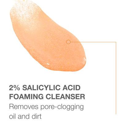 Neutrogena Acne Body Scrub with 2% Salicylic Acid – 8.5 oz Neutrogena